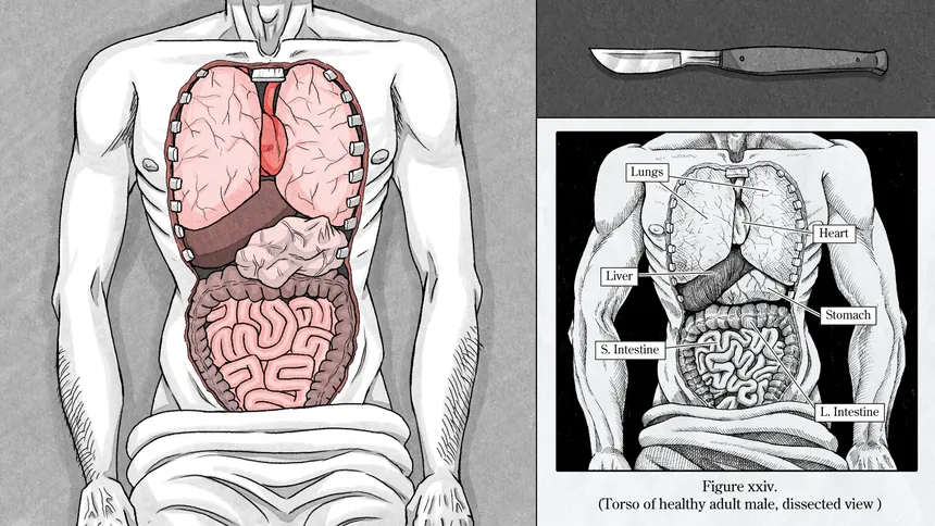 Скриншот 3 к игре Edwin Earstwhile: Medical Examiner