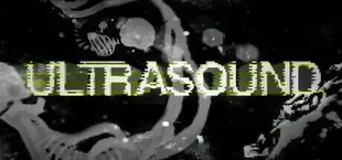Ultrasound