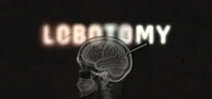 Lobotomy