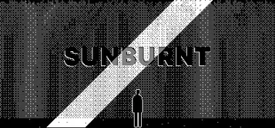 Sunburnt