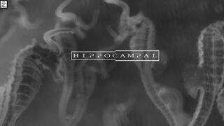 Скриншот 5 к игре Hippocampal: The White Sofa