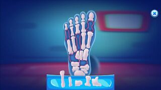 Скриншот 5 к игре Fix My Legs Doc