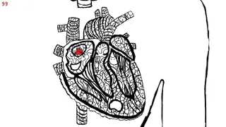 Let's Find Cats Inside the Human Body