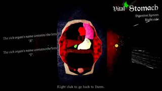Organ Failure