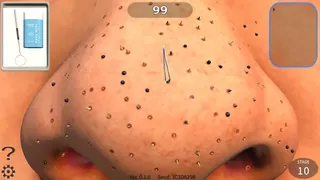 Pore Cleaning Simulator