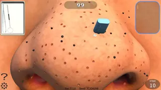 Pore Cleaning Simulator