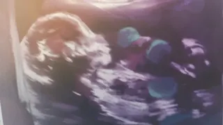 근손실 올까 봐 파멸엔딩은 거절합니다