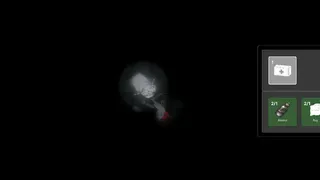 Auditum