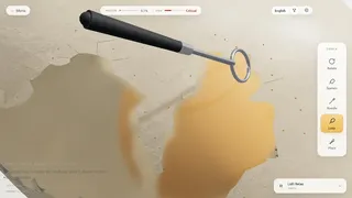 Raw Egg Peeling