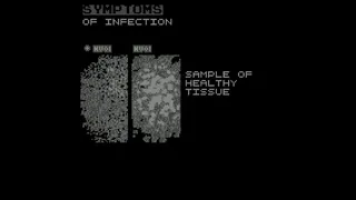 Скриншот 2 к игре Symptoms of Infection