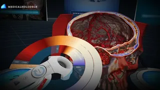 Скриншот 6 к игре MEDICALHOLODECK PRO FREE TRIAL | FULL FEATURES FOR 30 DAYS | Medical Virtual Reality | Medical VR | DICOM Viewer | Human Body VR | Human Anatomy | Virtual Surgery | Virtual Radiology  | Surgeon VR | 3D VR | Human Organs | Health | Healthcare | Nurse VR