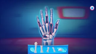 Скриншот 2 к игре Fix My Hand Doc