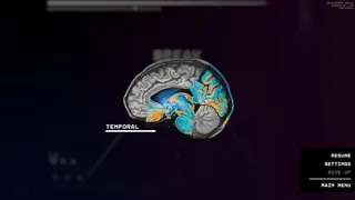 Скриншот 6 к игре Brainrot Game