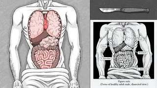 Скриншот 3 к игре Edwin Earstwhile: Medical Examiner