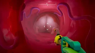 Скриншот 6 к игре Crack Surgeons 🍑
