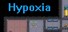 Memorial Park of Hypoxia