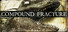 Compound Fracture